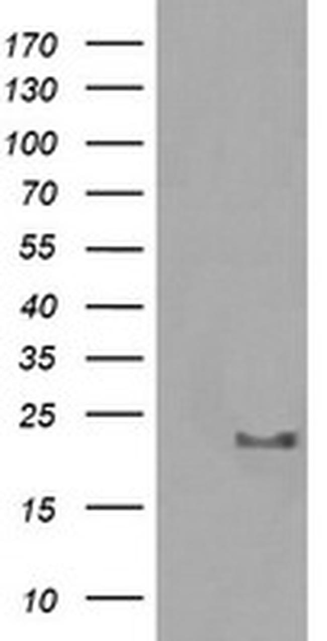 HRAS Antibody in Western Blot (WB)