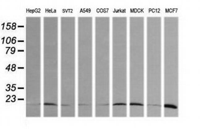 HRAS Antibody in Western Blot (WB)