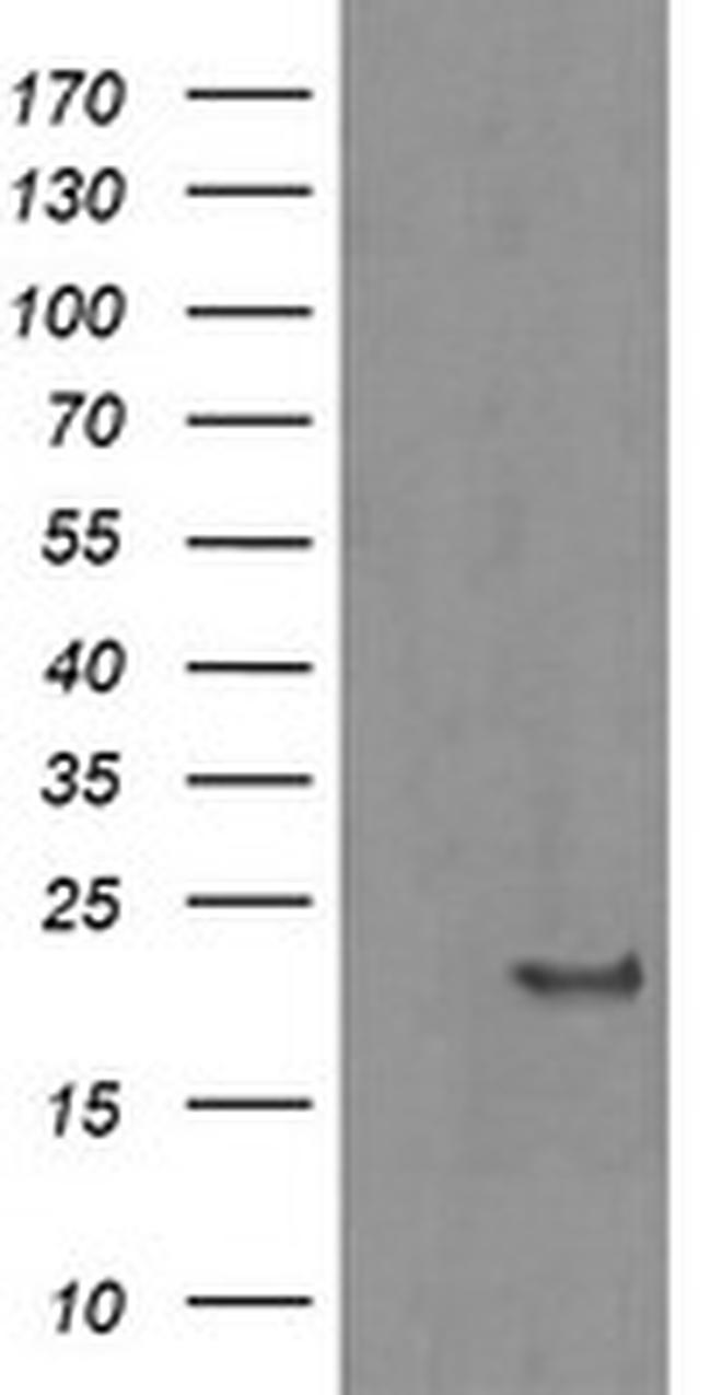 HRAS Antibody in Western Blot (WB)