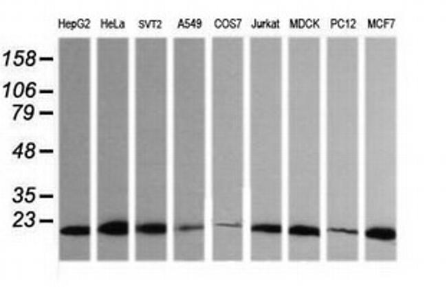 HRAS Antibody in Western Blot (WB)