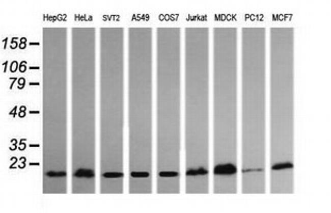 HRAS Antibody in Western Blot (WB)