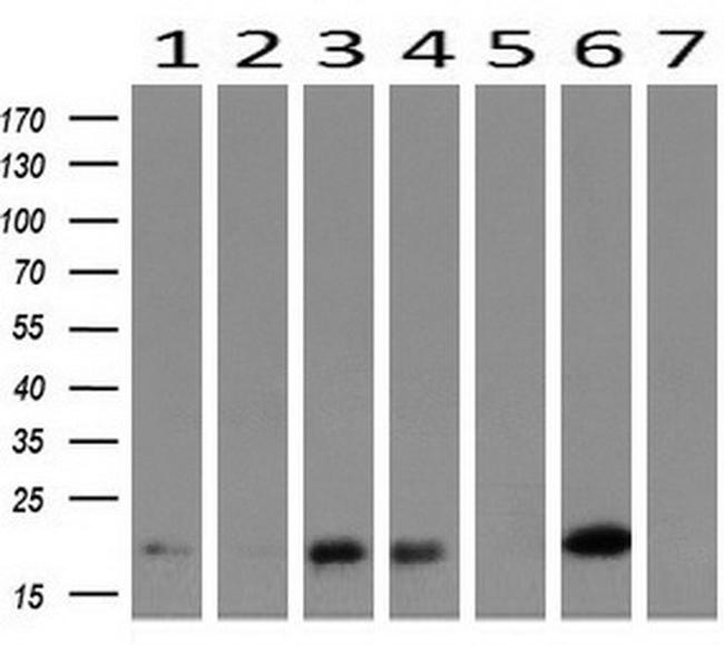 HRAS Antibody in Western Blot (WB)