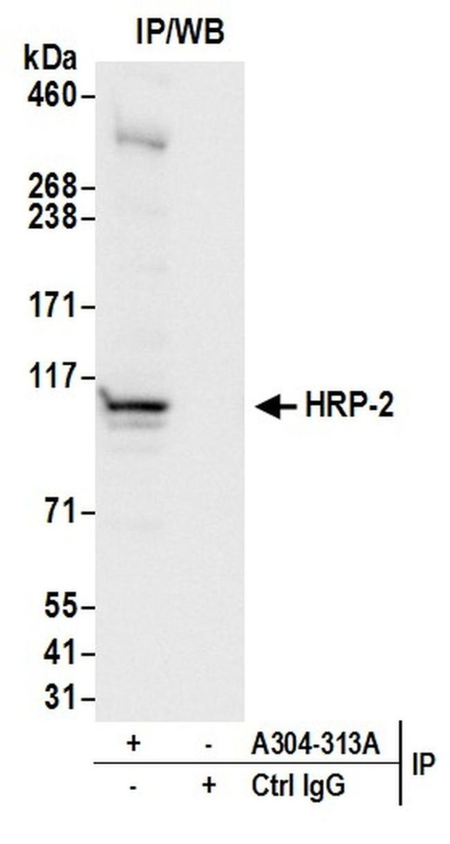 HRP-2 Antibody in Immunoprecipitation (IP)