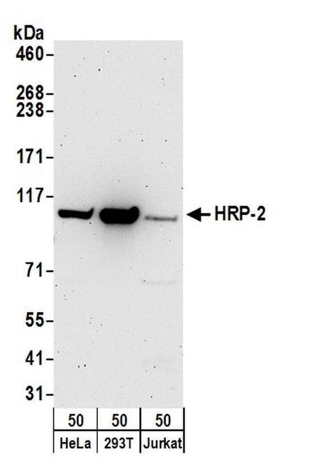 HRP-2 Antibody in Western Blot (WB)