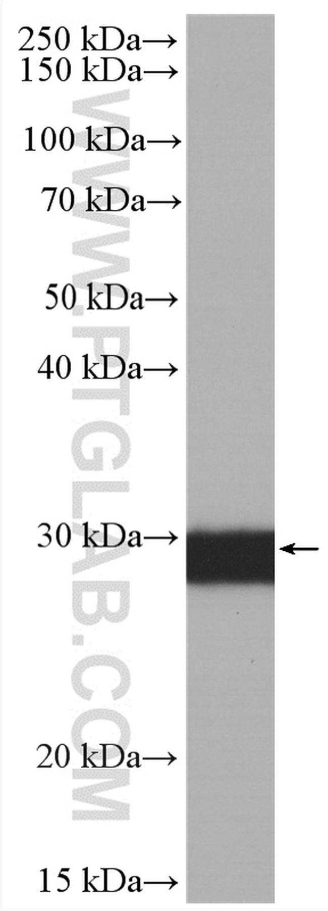 Calretinin Antibody in Western Blot (WB)