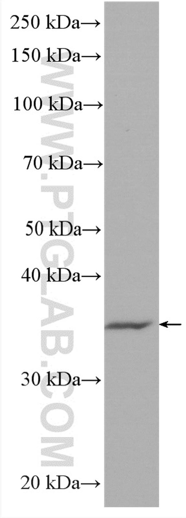 TYMS Antibody in Western Blot (WB)