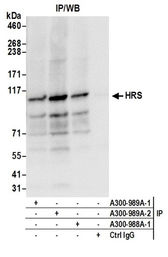 HRS Antibody in Western Blot (WB)