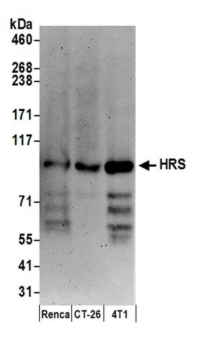 HRS Antibody in Western Blot (WB)