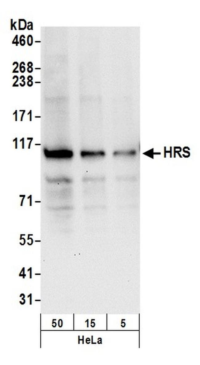 HRS Antibody in Western Blot (WB)