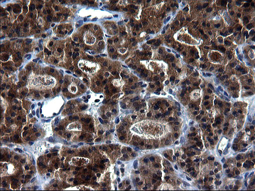 HSCB Antibody in Immunohistochemistry (Paraffin) (IHC (P))