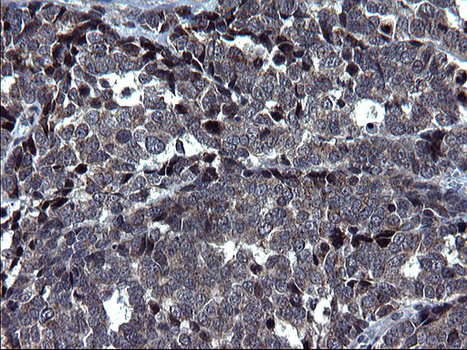 HSCB Antibody in Immunohistochemistry (Paraffin) (IHC (P))