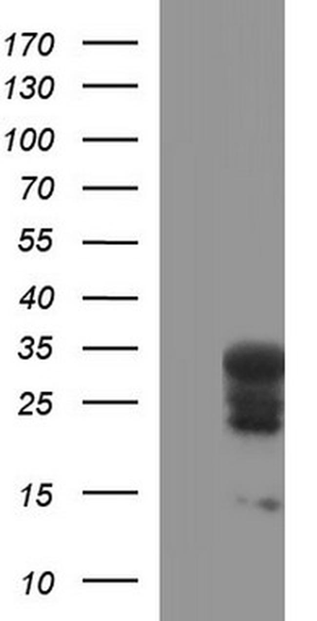 HSCB Antibody in Western Blot (WB)