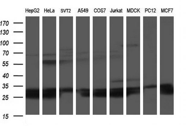 HSCB Antibody in Western Blot (WB)