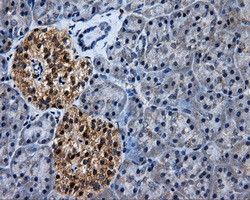 HSD17B10 Antibody in Immunohistochemistry (Paraffin) (IHC (P))