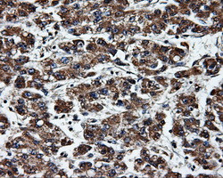 HSD17B10 Antibody in Immunohistochemistry (Paraffin) (IHC (P))