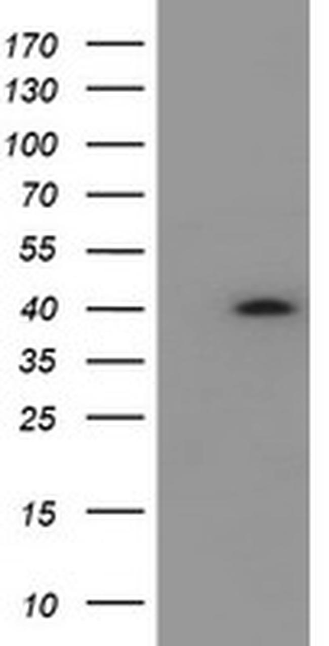 HSD17B2 Antibody in Western Blot (WB)