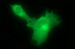 HSD17B4 Antibody in Immunocytochemistry (ICC/IF)