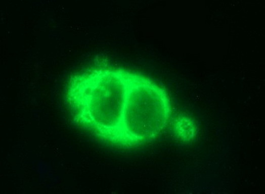 HSD17B4 Antibody in Immunocytochemistry (ICC/IF)