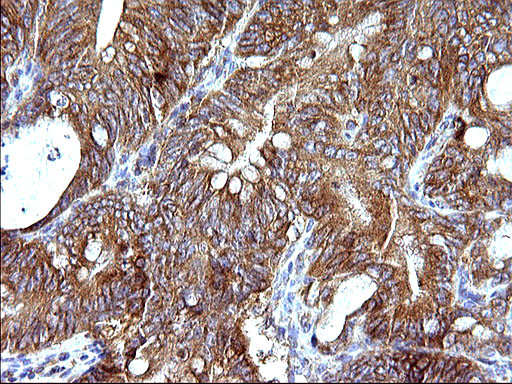 HSD17B4 Antibody in Immunohistochemistry (Paraffin) (IHC (P))