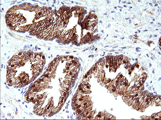 HSD17B4 Antibody in Immunohistochemistry (Paraffin) (IHC (P))