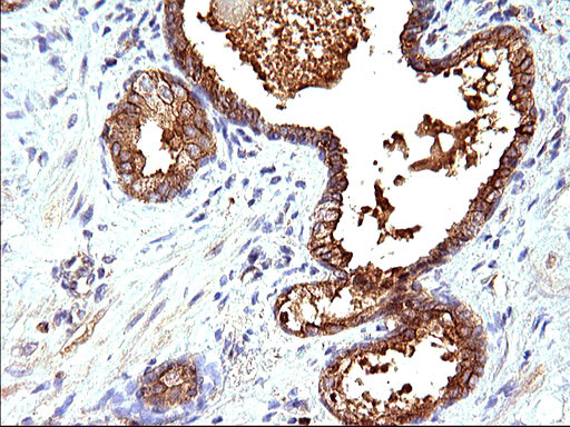 HSD17B4 Antibody in Immunohistochemistry (Paraffin) (IHC (P))