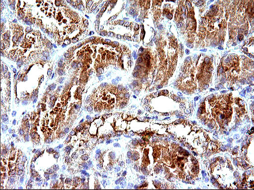 HSD17B4 Antibody in Immunohistochemistry (Paraffin) (IHC (P))