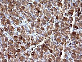 HSD17B4 Antibody in Immunohistochemistry (Paraffin) (IHC (P))