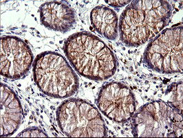 HSD17B4 Antibody in Immunohistochemistry (Paraffin) (IHC (P))