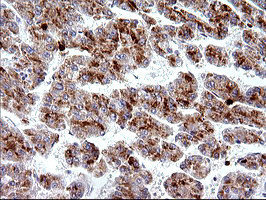 HSD17B4 Antibody in Immunohistochemistry (Paraffin) (IHC (P))