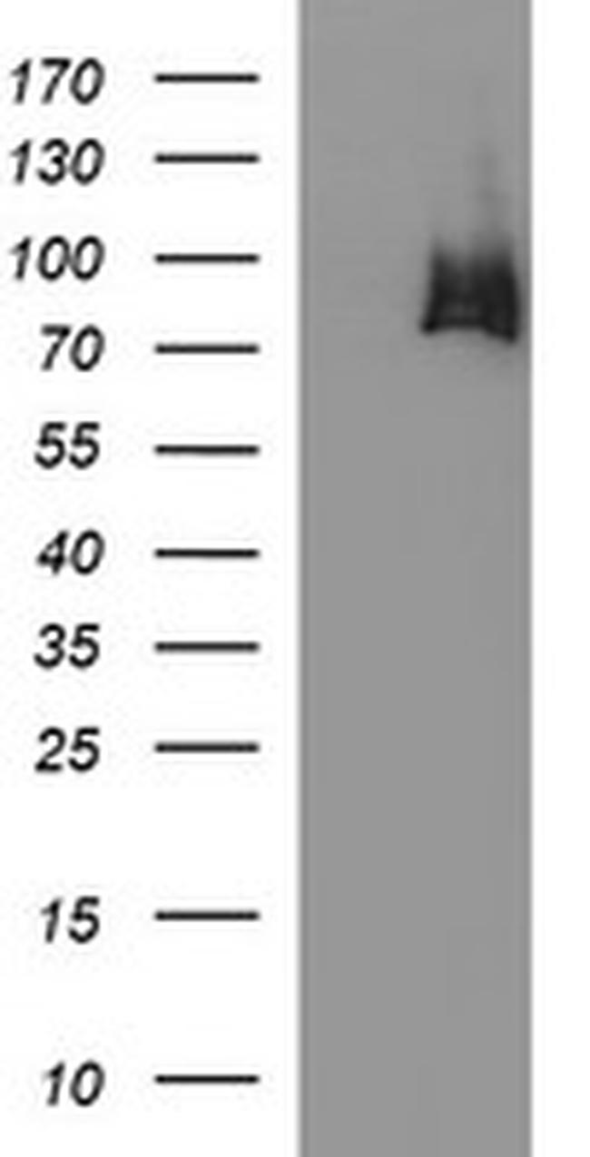 HSD17B4 Antibody in Western Blot (WB)