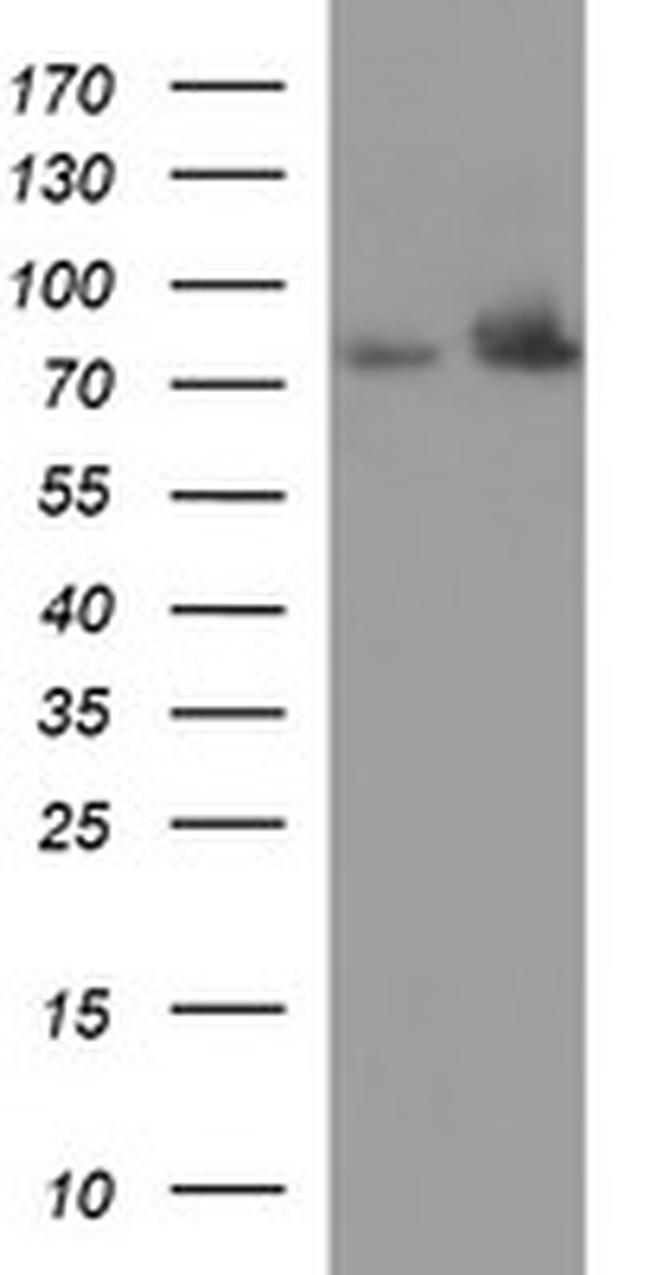 HSD17B4 Antibody in Western Blot (WB)