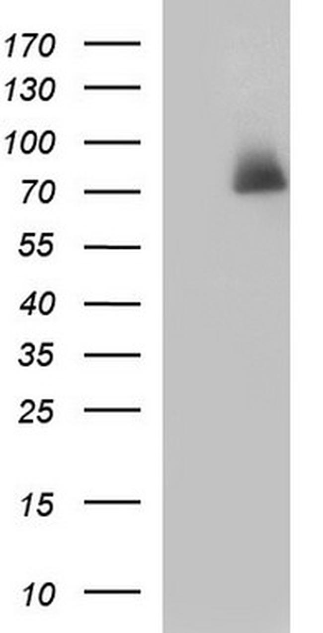 HSD17B4 Antibody in Western Blot (WB)