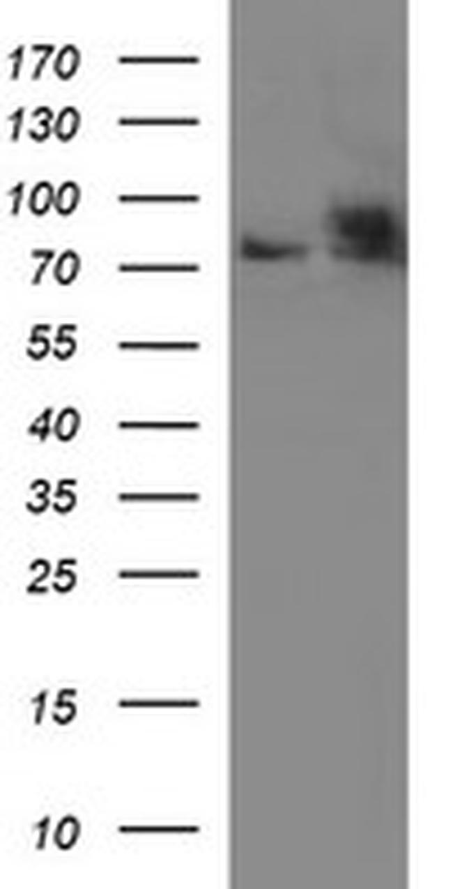 HSD17B4 Antibody in Western Blot (WB)