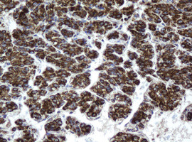 HSD17B8 Antibody in Immunohistochemistry (Paraffin) (IHC (P))