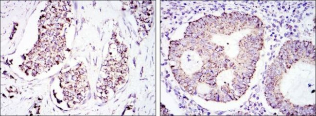 HSP60 Antibody in Immunohistochemistry (Paraffin) (IHC (P))