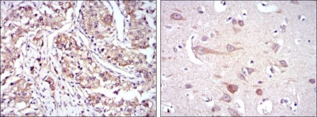 HSP90 beta Antibody in Immunohistochemistry (Paraffin) (IHC (P))