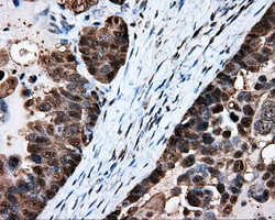 HSPA1A Antibody in Immunohistochemistry (Paraffin) (IHC (P))