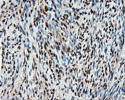 HSPA1A Antibody in Immunohistochemistry (Paraffin) (IHC (P))