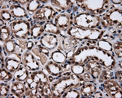 HSPA1A Antibody in Immunohistochemistry (Paraffin) (IHC (P))