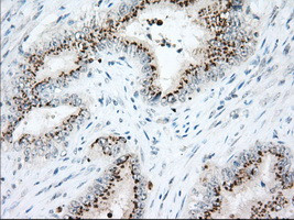 HSPA1A Antibody in Immunohistochemistry (Paraffin) (IHC (P))