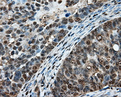 HSPA1A Antibody in Immunohistochemistry (Paraffin) (IHC (P))