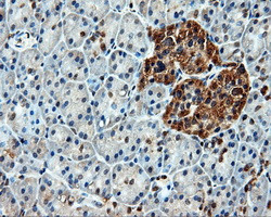 HSPA1A Antibody in Immunohistochemistry (Paraffin) (IHC (P))