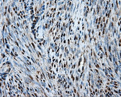 HSPA1A Antibody in Immunohistochemistry (Paraffin) (IHC (P))