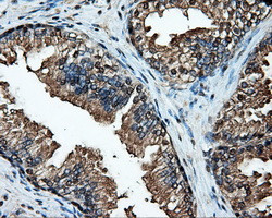 HSPA1A Antibody in Immunohistochemistry (Paraffin) (IHC (P))