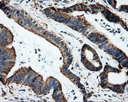 HSPA1A Antibody in Immunohistochemistry (Paraffin) (IHC (P))