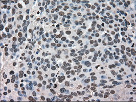 HSPA9 Antibody in Immunohistochemistry (Paraffin) (IHC (P))