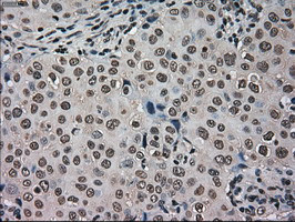 HSPA9 Antibody in Immunohistochemistry (Paraffin) (IHC (P))