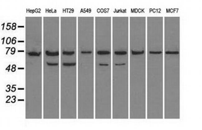 HSPA9 Antibody in Western Blot (WB)