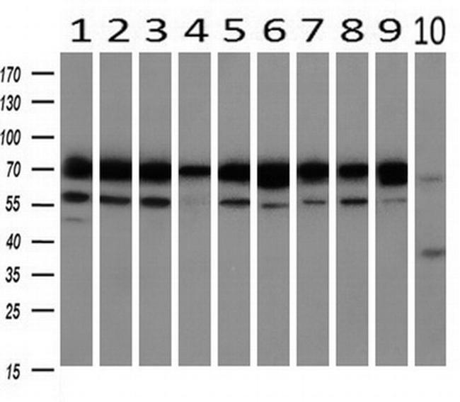 HSPA9 Antibody in Western Blot (WB)