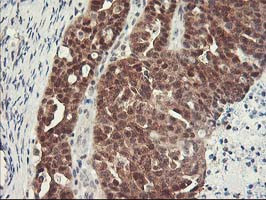 HSPBP1 Antibody in Immunohistochemistry (Paraffin) (IHC (P))